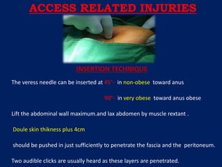 The veress needle can be inserted at 45°- in non-obese toward anus
90°- in very obese toward anus obese
Lift the abdominal wall maximum.and lax abdomen by muscle rextant .
Doule skin thikness plus 4cm
should be pushed in just sufficiently to penetrate the fascia and the peritoneum.
Two audible clicks are usually heard as these layers are penetrated.
INSERTION TECHNIQUE
ACCESS RELATED INJURIES
 