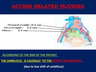 ACCORDING TO THE BMI OF THE PATIENT
THE UMBILICUS IS CAUDALLY TO THE AORTIC BIFURCATION .
(due to low shift of umbilicus)
ACCESS RELATED INJURIES
 