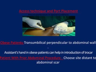 Access technique and Port Placement
Pneumoperitoneum In Special Conditions
Obese Patients-Transumbilical perpendicular to abdominal wall
.
Assistant’shandinobesepatientscanhelpinintroductionoftrocar
Patient With Prior Abdominal Procedure - Choose site distant to
abdominal scar
 