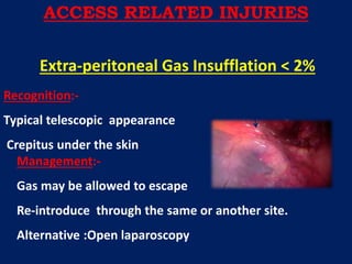 Management:-
Gas may be allowed to escape
Re-introduce through the same or another site.
Alternative :Open laparoscopy
Extra-peritoneal Gas Insufflation < 2%
Recognition:-
Typical telescopic appearance
Crepitus under the skin
ACCESS RELATED INJURIES
 