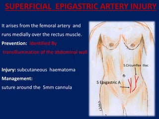 SUPERFICIAL EPIGASTRIC ARTERY INJURY
S.Circumflex Iliac
S Epigastric A
It arises from the femoral artery and
runs medially over the rectus muscle.
Prevention: Identified By
transillumination of the abdominal wall
Injury: subcutaneous haematoma
Management:
suture around the 5mm cannula
 