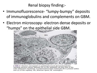 Renal biopsy finding:-
• Immunofluorescence- “lumpy-bumpy” deposits
of immunoglobulins and complements on GBM.
• Electron microscopy- electron dense deposits or
“humps” on the epithelial side GBM.
 