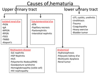 Causes of hematuria
Upper urinary tract lower urinary tract
-UTI, cystitis, urethritis
-Urolithiasis
-Trauma
-Coagulopathy
-Heavy exercise
-Bladder tumor
Isolated renal d’se
-PIGN
-IgA
-MPGN
-RPGN
-FSGS
-TMBD
-Aloport’s
Multisystem disease
-SLE nephritis
-HSP Nephritis
-HUS
-Polyarteritis Nodosa(PAN)
-Goodpasture syndrome
-Hemoglobinopahty (sickle cell)
-HIV nephropathy
Tubulointerstitial d’se
-ATN
-Papillary necrosis
-Pyelonephritis
-Interstitial nephritis
Anatomical
-Hydronephrosis
-Polycystic kidney d’se
-Multicystic dysplasia
-Renal tumor
 
