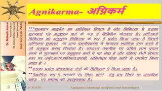 Agni karma in Ayurved Dr Mahesh Kumar New delhi