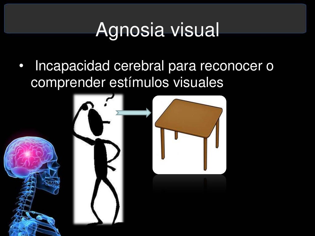 Agnosia