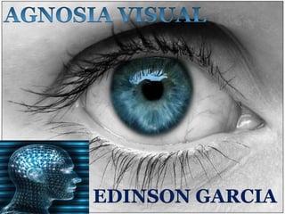 AGNOSIA VISUAL EDINSON GARCIA 
