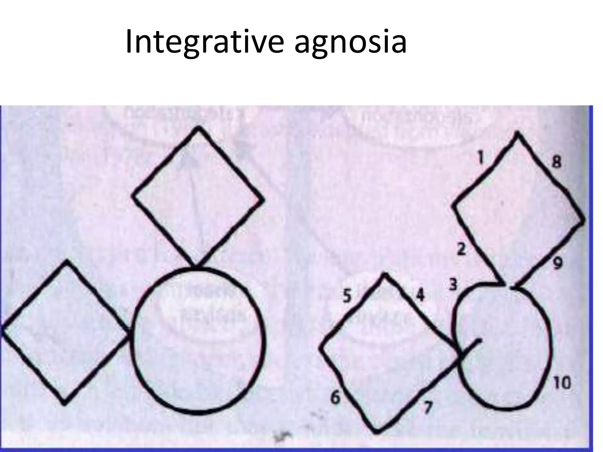 Integrative agnosia
 
