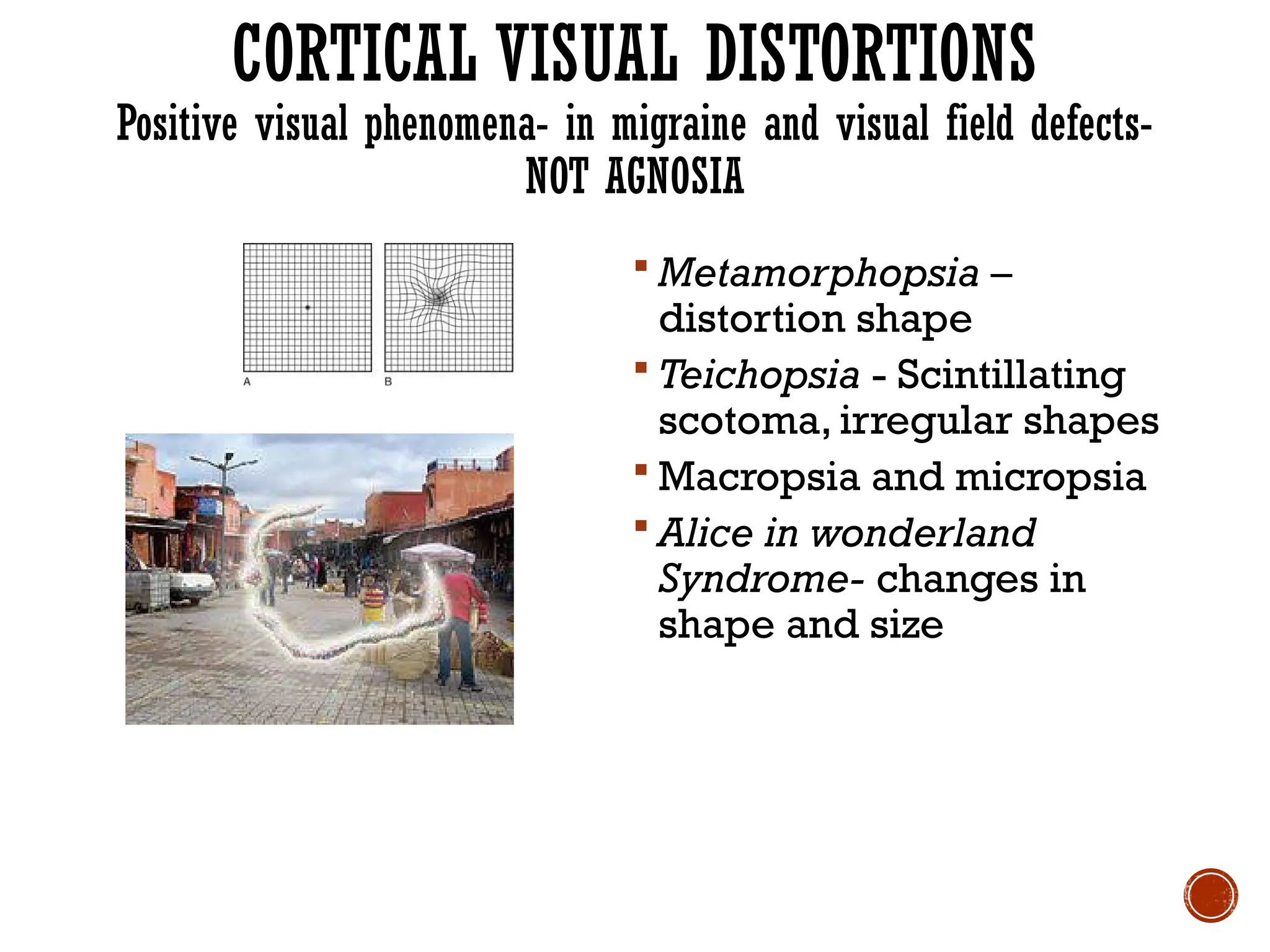 CORTICAL VISUAL DISTORTIONS
Positive visual phenomena- in migraine and visual field defects-
NOT AGNOSIA
 Metamorphopsia –
distortion shape
 Teichopsia - Scintillating
scotoma, irregular shapes
 Macropsia and micropsia
 Alice in wonderland
Syndrome- changes in
shape and size
 