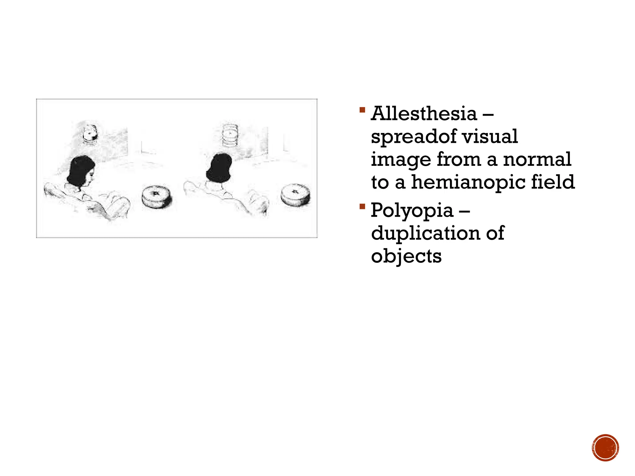  Allesthesia –
spreadof visual
image from a normal
to a hemianopic field
 Polyopia –
duplication of
objects
 