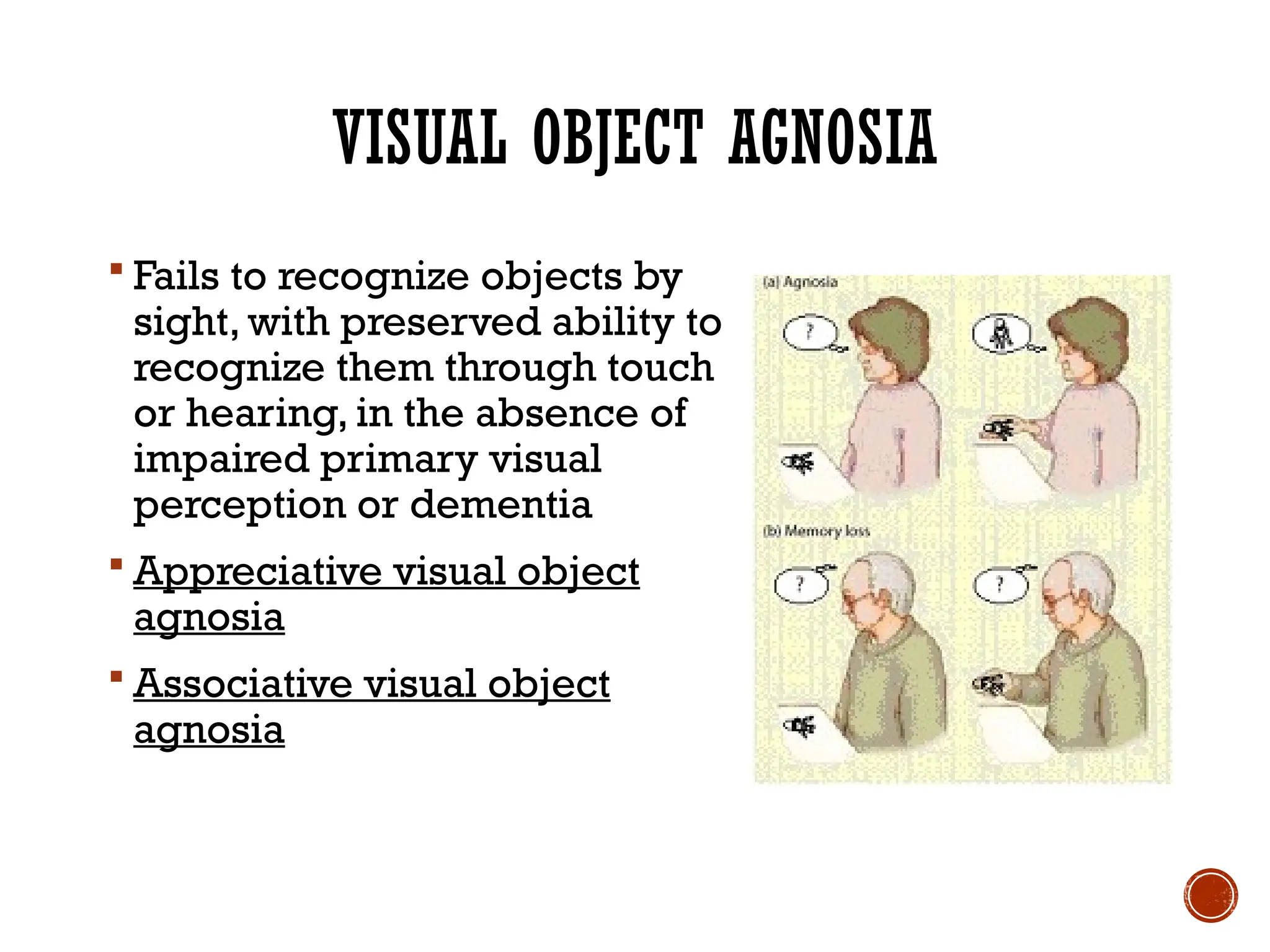 VISUAL OBJECT AGNOSIA
 Fails to recognize objects by
sight, with preserved ability to
recognize them through touch
or hearing, in the absence of
impaired primary visual
perception or dementia
 Appreciative visual object
agnosia
 Associative visual object
agnosia
 