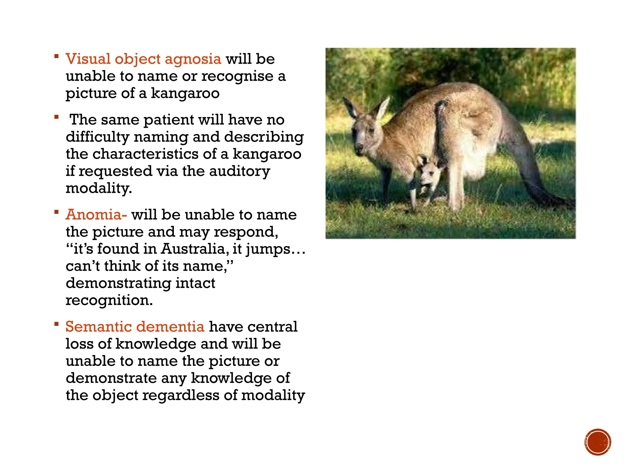  Visual object agnosia will be
unable to name or recognise a
picture of a kangaroo
 The same patient will have no
difficulty naming and describing
the characteristics of a kangaroo
if requested via the auditory
modality.
 Anomia- will be unable to name
the picture and may respond,
“it’s found in Australia, it jumps…
can’t think of its name,”
demonstrating intact
recognition.
 Semantic dementia have central
loss of knowledge and will be
unable to name the picture or
demonstrate any knowledge of
the object regardless of modality
 