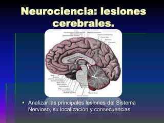 Neurociencia: lesiones
     cerebrales.




 Analizar las principales lesiones del Sistema
  Nervioso, su localización y consecuencias.
 