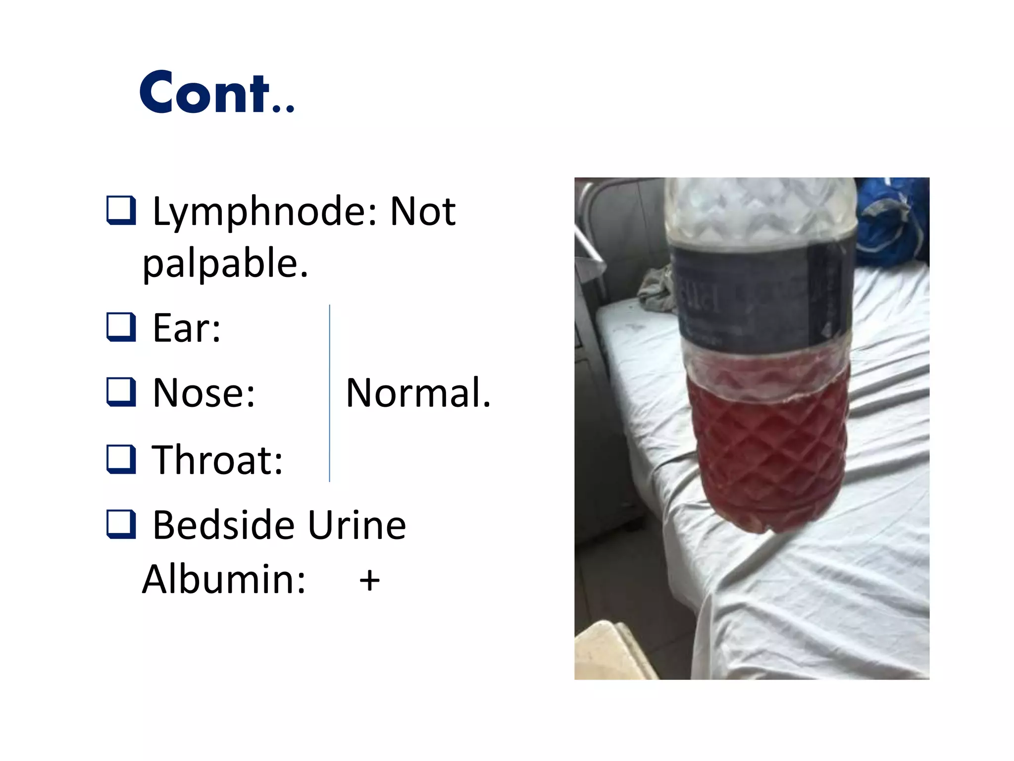Cont..
 Lymphnode: Not
palpable.
 Ear:
 Nose: Normal.
 Throat:
 Bedside Urine
Albumin: +
 