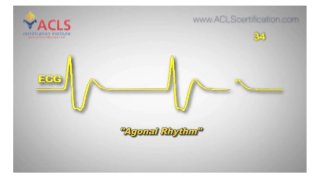 Agonal Rhythm by ACLS Certification Institute
