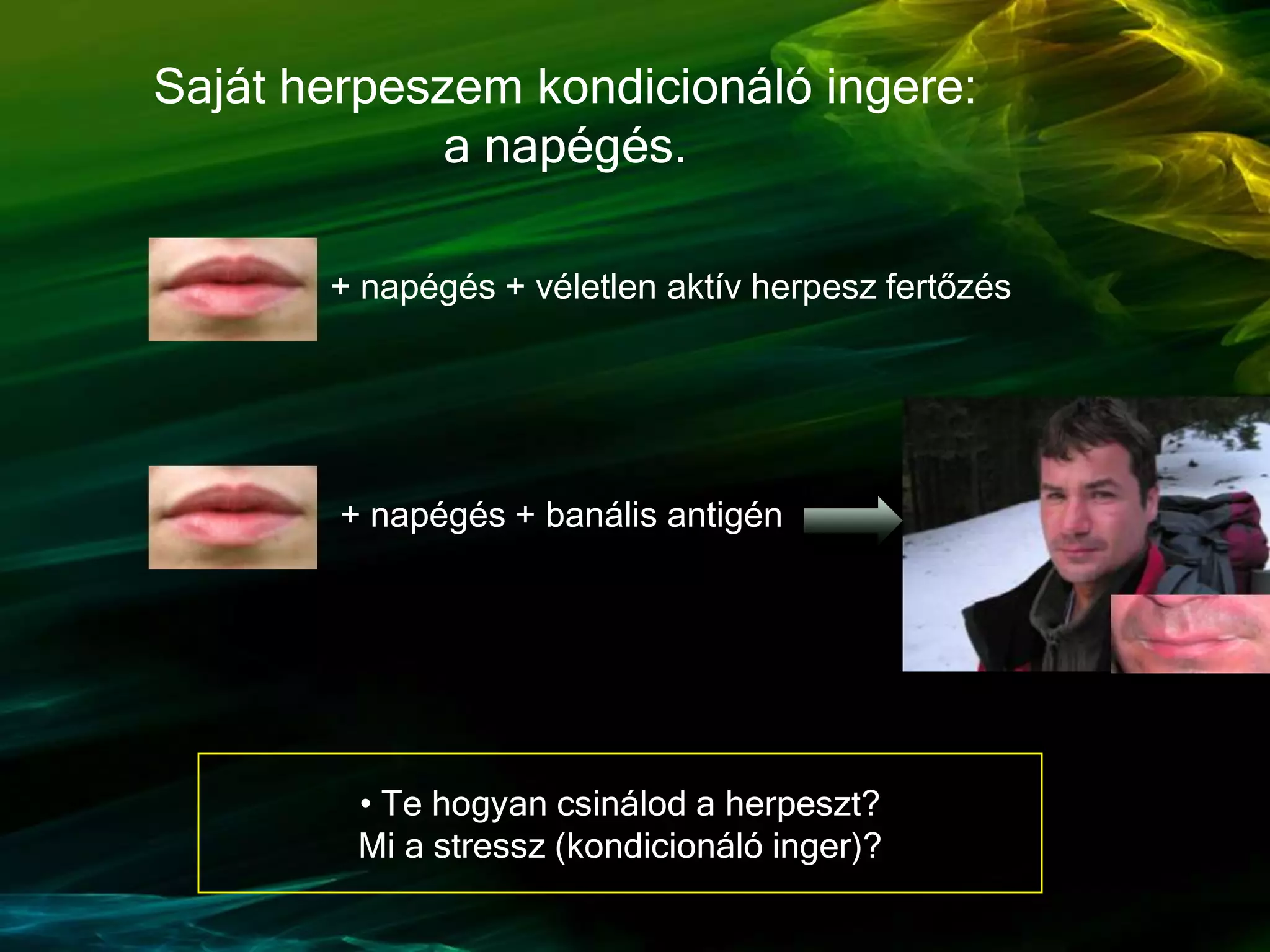 Saját herpeszem kondicionáló ingere:
a napégés.
+ napégés + véletlen aktív herpesz fertőzés
+ napégés + banális antigén
• Te hogyan csinálod a herpeszt?
Mi a stressz (kondicionáló inger)?
 