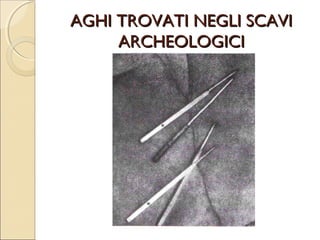 MECCANISMO DI AZIONE
       DELL’AGOPUNTURA.
ANALGESICA:    TRAMITE LE FIBRE NERVOSE
 A DELTA E A BETA (FIBRE CHE
 CONDUCONO IL DOLORE E STIMOLI DI
 ALTRA NATURA)
MIORILASSANTE: AZIONE DIRETTA
 DELL’AGO SULLA FIBBRA MUSCOLARE.
ANTINFIAMMATORIA.
NEURO ENDOCRINA
 (NEUROTRASMETTITORI E SOSTANZE
 OPPIOIDI ENDOGENI)
 