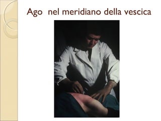 DIVERSITÀ DI VALUTAZIONE.
                   Domanda più frequente.

 L’AGOPUNTURA          NON FUNZIONA
 È una denuncia acritica, disinformata, ascientifica.
 L’AGOPUNTURA           FUNZIONA
 spiegazioni scientifiche e fisiologiche sulle modalità di
 azione.
 L’AGOPUNTURA         FUNZIONA COME CREDENZA
 medicina onnipotente, l’incontro con l’agopuntore è
 immaginato come un luogo con aromi orientali e con medici
 con aspetto ascetico, con chimoni multi colorati: il paziente
 crede a questo contesto

       È IL MITO DELL’AGOPUNTURA.
 