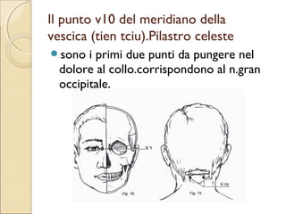 ESISTONO VERAMENTE I PUNTI DI
         AGOPUNTURA?
 Sono    stati compiuti studi sulla entità anatomica dei punti.

 Ogni   studio è incompleto e manca di seri e veri controlli.

 Pur  essendoci nell’epidermide corrispondente, una resistenza
  elettrica minore e conduttanza maggiore, riscontrata anche
  nel cadavere, i punti corrispondono alle terminazioni nervose
  di:

 Tutte le fibre amieliniche le quali unendosi tra loro formano
  un atmosfera sinaptica che stimolata crea fenomeni ionici
  coinvolgenti le    strutture vicine e lontane del

 Sistema   nervoso.
 