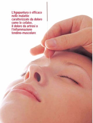 EDS08-02 OK

19-02-2008

10:56

Pagina 20

L’Agopuntura è efficace
nelle malattie
caratterizzate da dolore
come le cefalee,
il dolore da artrosi o
l’infiammazione
tendino-muscolare

 