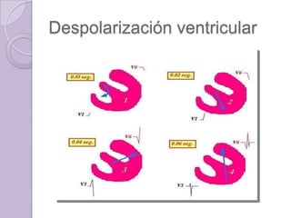 Despolarización ventricular

 