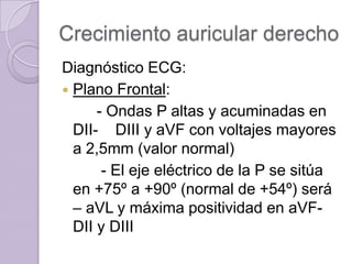 Crecimiento auricular derecho
Diagnóstico ECG:
 Plano Frontal:
- Ondas P altas y acuminadas en
DII- DIII y aVF con voltajes mayores
a 2,5mm (valor normal)
- El eje eléctrico de la P se sitúa
en +75º a +90º (normal de +54º) será
– aVL y máxima positividad en aVFDII y DIII

 