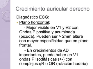 Crecimiento auricular derecho
Diagnóstico ECG:
 Plano horizontal:
- Mejor visible en V1 y V2 con
Ondas P positiva y acuminada
(picuda). Pueden ser > 2mm altura
con mayor especificidad que en plano
frontal.
- En crecimientos de AD
importantes, puede haber en V1
ondas P isodifásicas (+-) con
complejos qR o QR (rotación horaria)

 