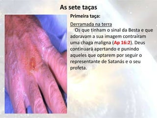 As sete taças
   Primeira taça:
   Derramada na terra
     Os que tinham o sinal da Besta e que
   adoravam a sua imagem contraíram
   uma chaga maligna (Ap 16:2). Deus
   continuará apertando e punindo
   aqueles que optarem por seguir o
   representante de Satanás e o seu
   profeta.
 