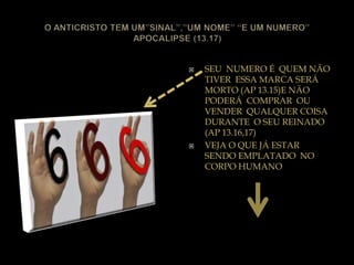  SEU NUMERO É QUEM NÃO
TIVER ESSA MARCA SERÁ
MORTO (AP 13.15)E NÃO
PODERÁ COMPRAR OU
VENDER QUALQUER COISA
DURANTE O SEU REINADO
(AP 13.16,17)
 VEJA O QUE JÁ ESTAR
SENDO EMPLATADO NO
CORPO HUMANO
 