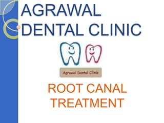 AGRAWAL
DENTAL CLINIC


  ROOT CANAL
  TREATMENT
 