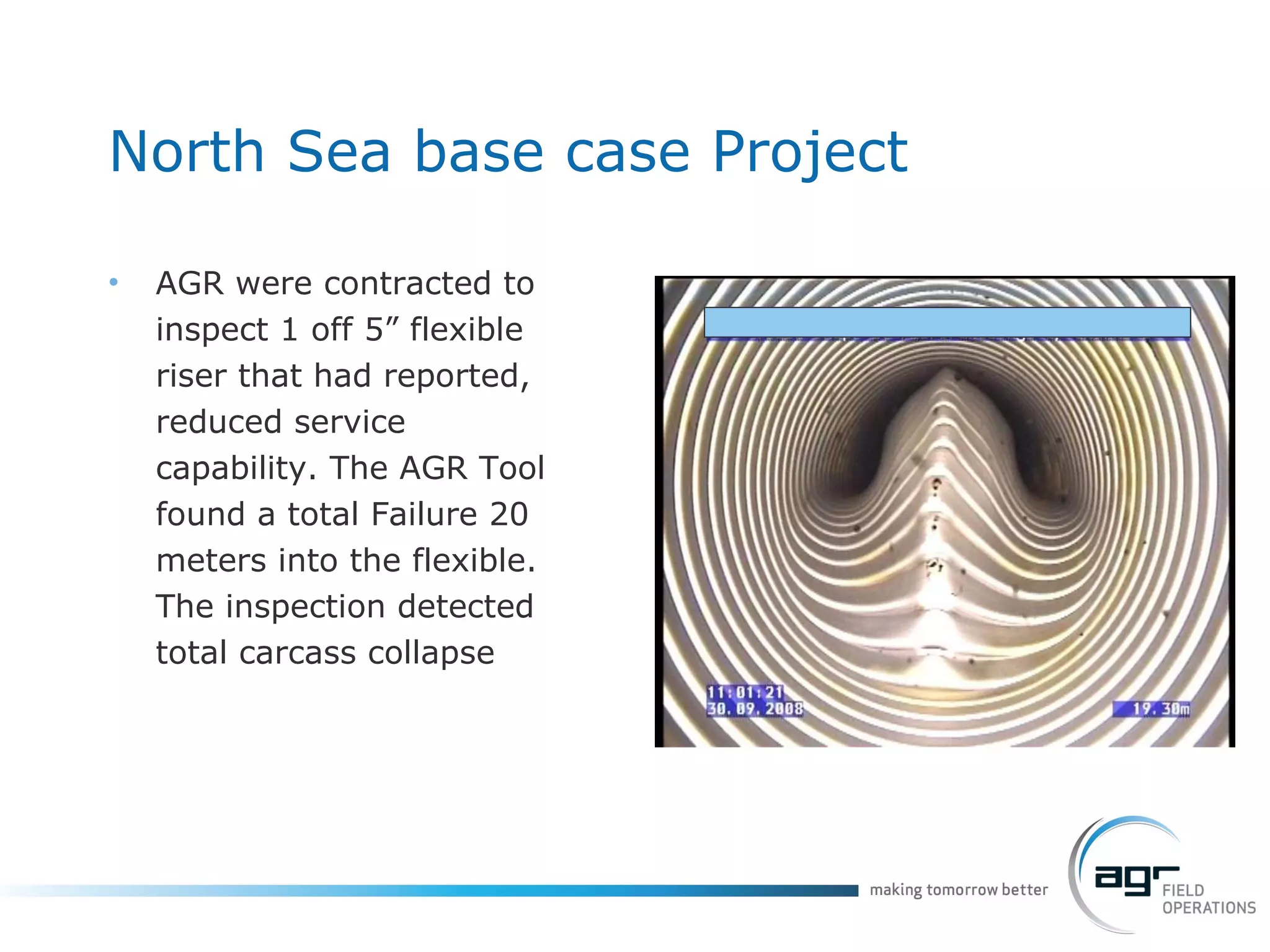 North Sea base case Project AGR were contracted to inspect 1 off 5” flexible riser that had reported, reduced service  capability. The AGR Tool found a total Failure 20 meters into the flexible. The inspection detected total carcass collapse 