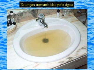 Doenças transmitidas pela água
 