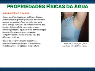 ALTO ESPECÍFICO ELEVADO:
Calor específico elevado: as moléculas de água
podem absorver grande quantidade de calor sem
que sua temperatura fique elevada, pois parte
desta energia é utilizada no enfraquecimento das
ligações de hidrogênio. Isso explica o papel
termorregulador da água por meio da transpiração
que mantém a temperatura em valores
compatíveis com a manutenção da vida das
diferentes espécies.
Devido ao seu elevado calor específico, a
abundante presença de água nos seres vivos
impede grandes variações de temperatura.
SUOR EXCESSIVO 0,5 a 1,5% da
população sofre de hiper-hidrose
PROPRIEDADES FÍSICAS DA ÁGUAPROPRIEDADES FÍSICAS DA ÁGUA
 
