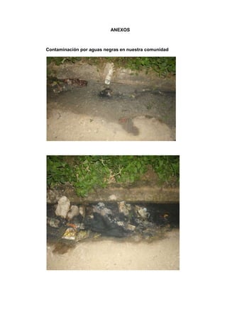 ANEXOS



Contaminación por aguas negras en nuestra comunidad
 