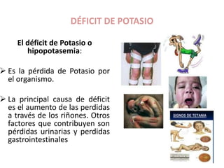 DÉFICIT DE POTASIO
El déficit de Potasio o
hipopotasemia:
 Es la pérdida de Potasio por
el organismo.
 La principal causa de déficit
es el aumento de las perdidas
a través de los riñones. Otros
factores que contribuyen son
pérdidas urinarias y perdidas
gastrointestinales
 