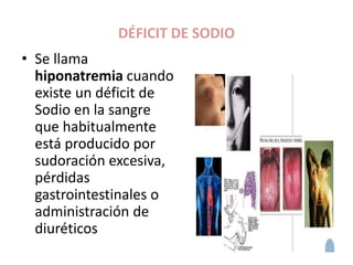 DÉFICIT DE SODIO
• Se llama
hiponatremia cuando
existe un déficit de
Sodio en la sangre
que habitualmente
está producido por
sudoración excesiva,
pérdidas
gastrointestinales o
administración de
diuréticos
 