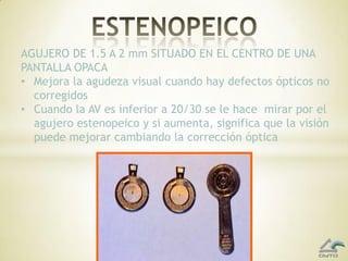 Anotar la línea más pequeñaque vea