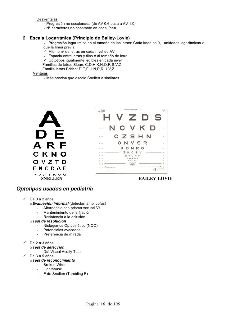 Agudeza Visual