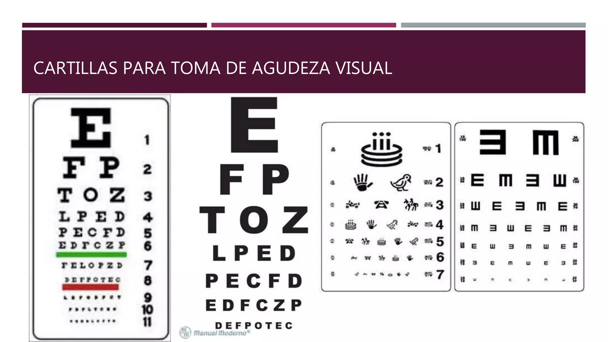 Agudeza visual | PPT