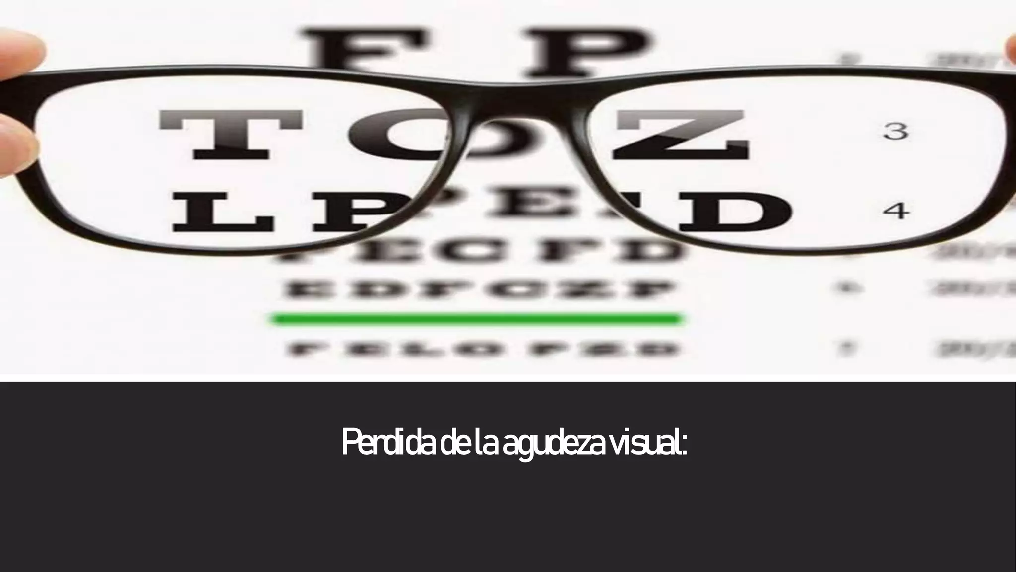 agudeza visual.pptx