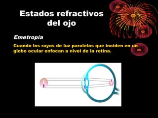 Estados refractivos
del ojo
Emetropía
Cuando los rayos de luz paralelos que inciden en un
globo ocular enfocan a nivel de la retina.
 