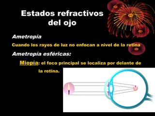 Ametropía
Cuando los rayos de luz no enfocan a nivel de la retina
Ametropía esféricas:
Miopía: el foco principal se localiza por delante de
la retina.
Estados refractivos
del ojo
 