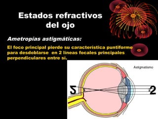 Estados refractivos
del ojo
Ametropías astigmáticas:
El foco principal pierde su característica puntiforme
para desdoblarse en 2 líneas focales principales
perpendiculares entre sí.
 