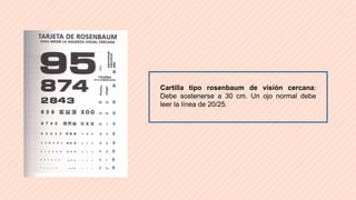 agudeza visual oftalmologia.pptx