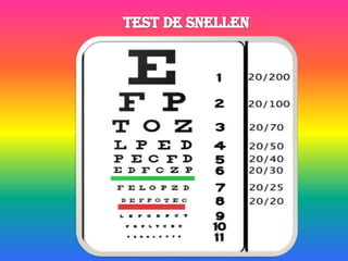 Test de Snellen