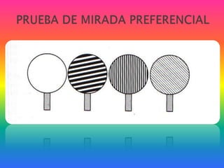 PRUEBA DE MIRADA PREFERENCIAL