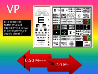 VPEsta expresión representa la d equivalente a la cual el ojo discrimina el ángulo visual 1°