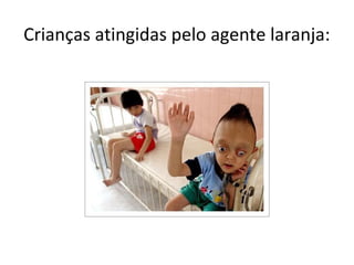 Crianças atingidas pelo agente laranja:
 