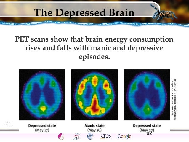 AP Abnormal Psych