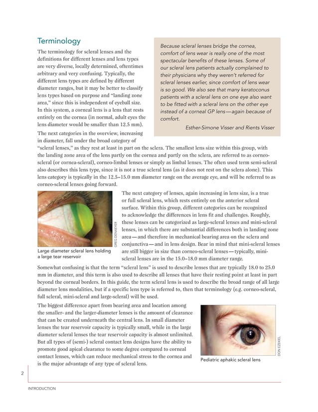 A guide to scleral lens fitting