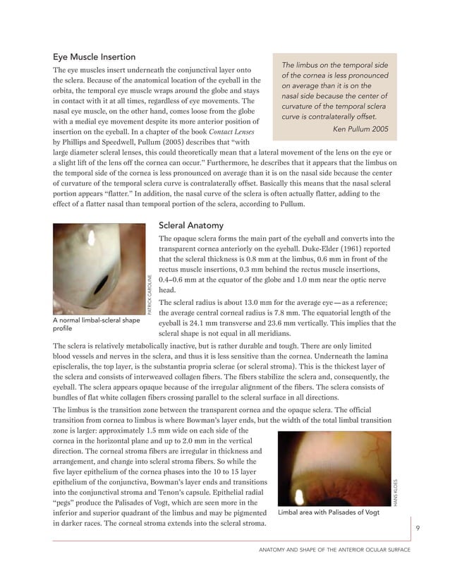 A guide to scleral lens fitting